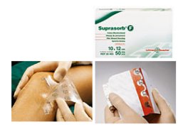 MEDICAZIONE STERILE IN FILM IN POLIURETANO TRASP. SUPRASORB F 10X12CM 10 PEZZI - Farmacia Dott. Pasquale Russo