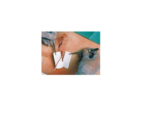 MEDICAZIONE PER TUBI DI DRENAGGIO FESSURATA METALLINE DRAIN 6X7CM FORO 4,5X11MM 50 PEZZI - Farmacia Dott. Pasquale Russo