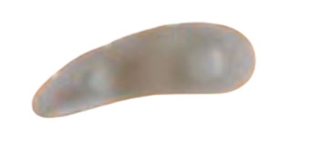 CUSCINETTO ORIONE G114 3 ANELLI PER DITA A MARTELLO DESTRO MISURA UNICA - Farmacia Dott. Pasquale Russo